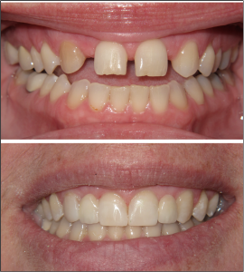 cosmetic dentisry sydney teeth repair