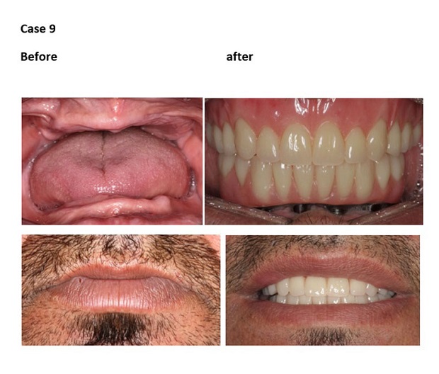 cosmetic dentistry before and after 10 10new