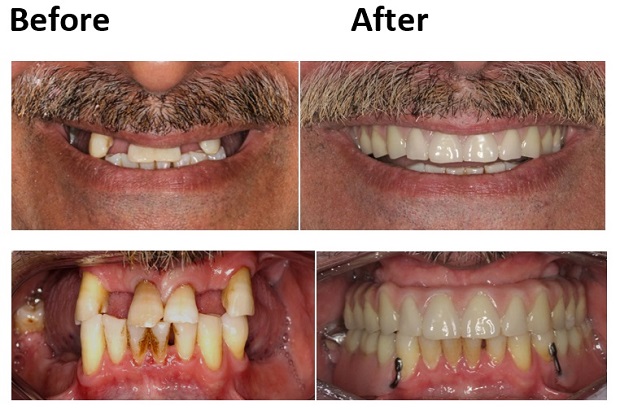 cosmetic dentistry before and after 11