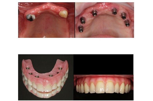 cosmetic dentistry before and after 33
