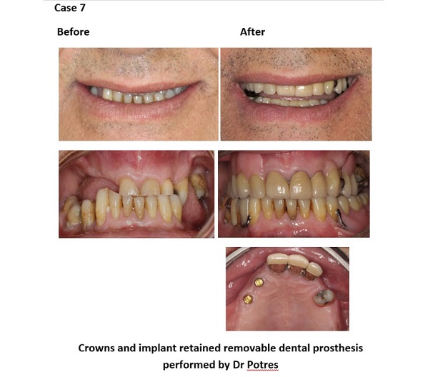 cosmetic dentistry before and after 88 new