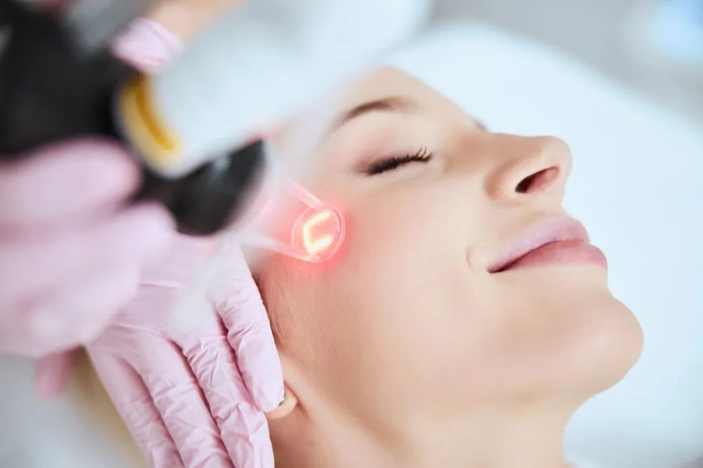 Fractional CO2 Laser Treatment